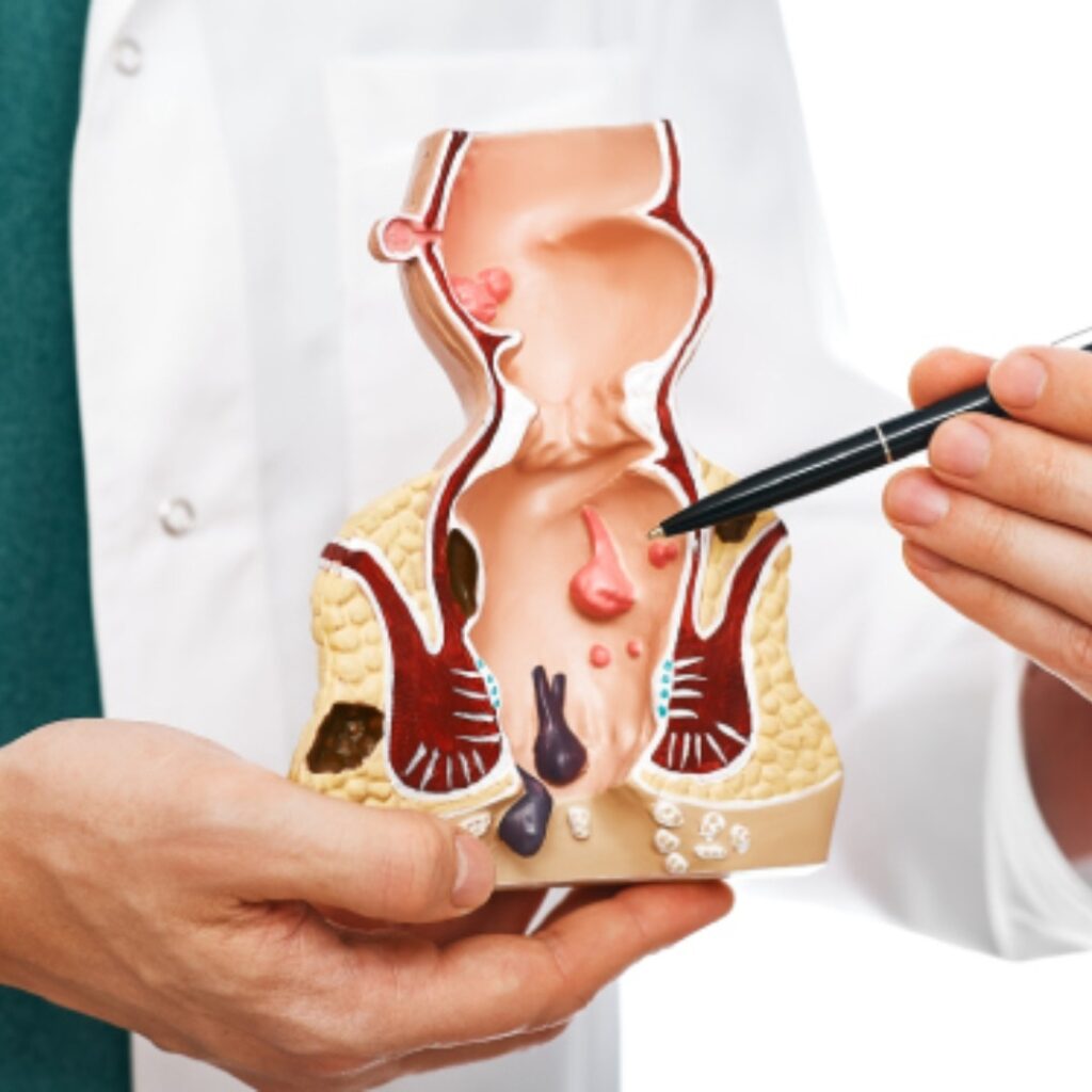 Piles Specialist Doctor